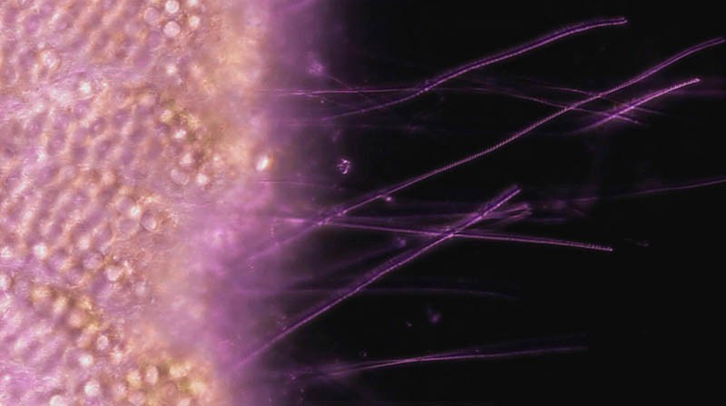 Les filaments urticants injectent des toxines qui immobilisent les proies 